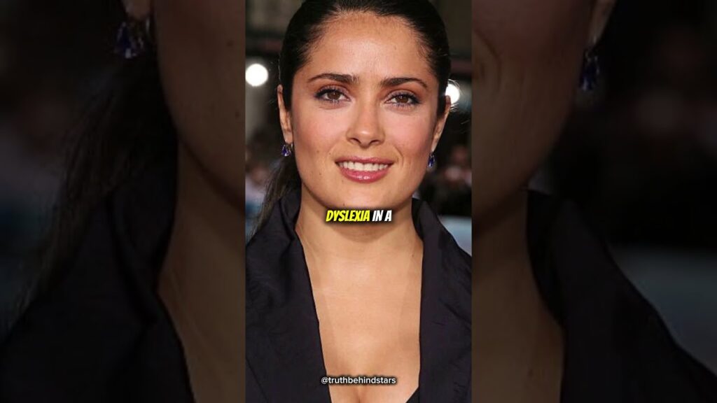 The illness that almost destroyed his career #SalmaHayek #HollywoodSecrets #Frida The illness that almost destroyed his career #SalmaHayek #HollywoodSecrets #Frida