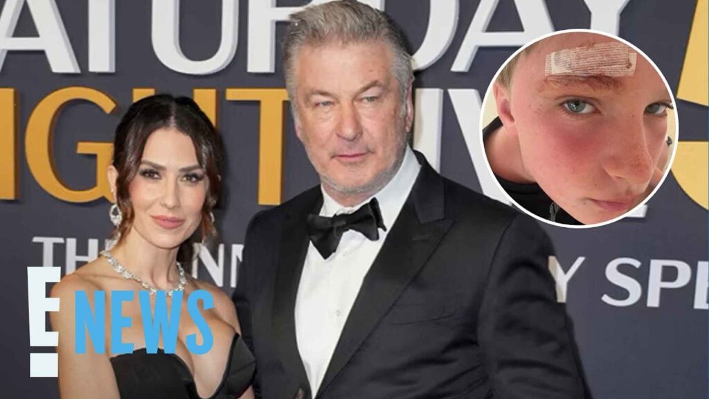 Alec Baldwin, Hilaria Baldwin's Son Leo, 9, Splits Forehead Open | E! News