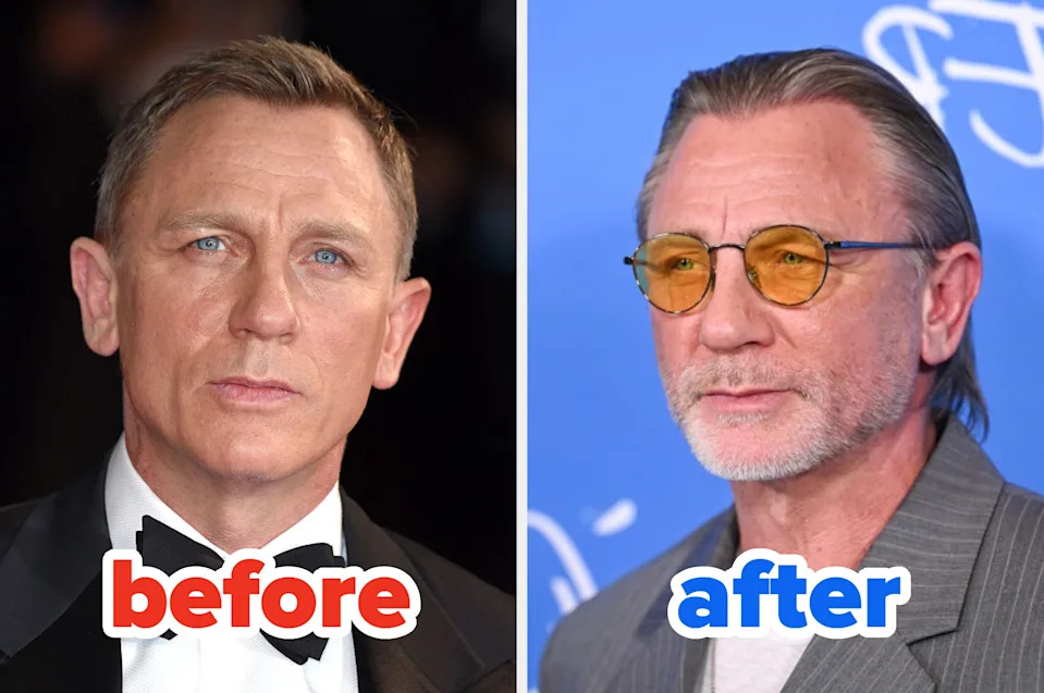 Split image of a celebrity: left shows them in formal attire, right casual with sunglasses and facial hair; labeled "before" and "after."