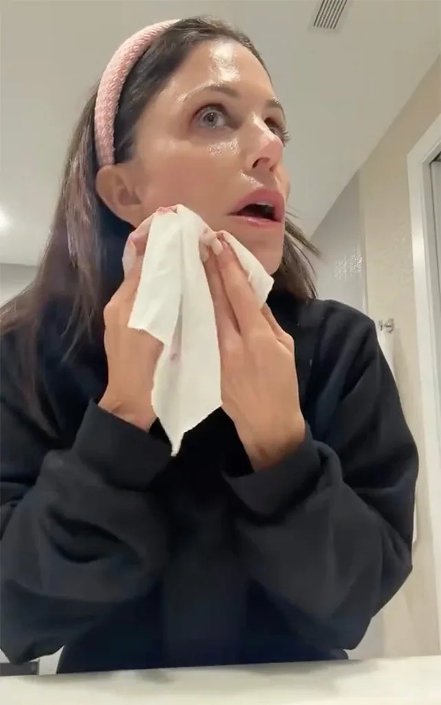 Bethenny Frankel, Instagram, Face Bleeding