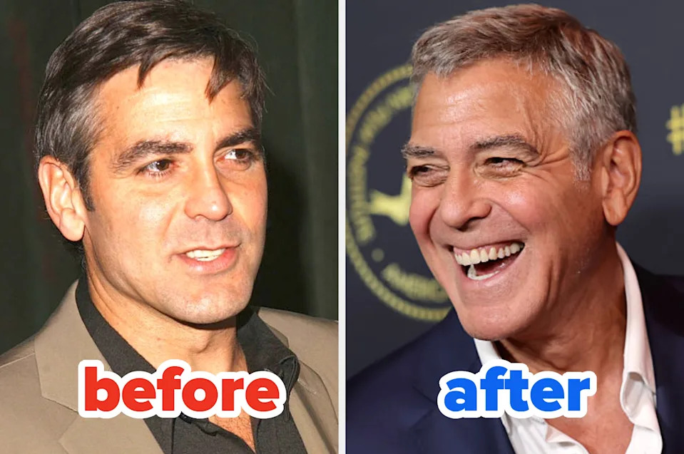 Two side-by-side photos of a man labeled "before" and "after," highlighting his younger and older appearances