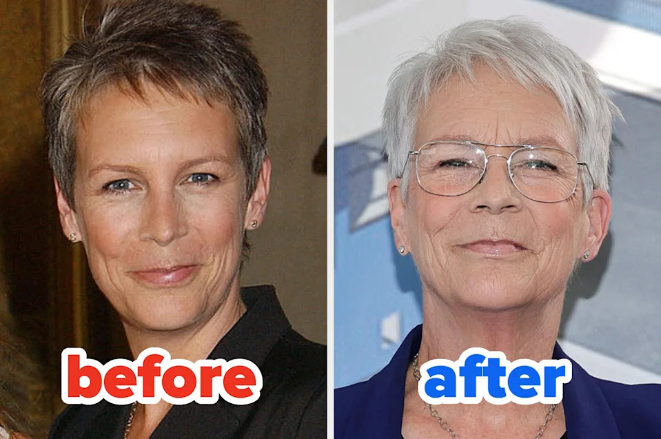Two side-by-side images of the same woman showing her youthful and aged appearances, labeled "before" and "after."