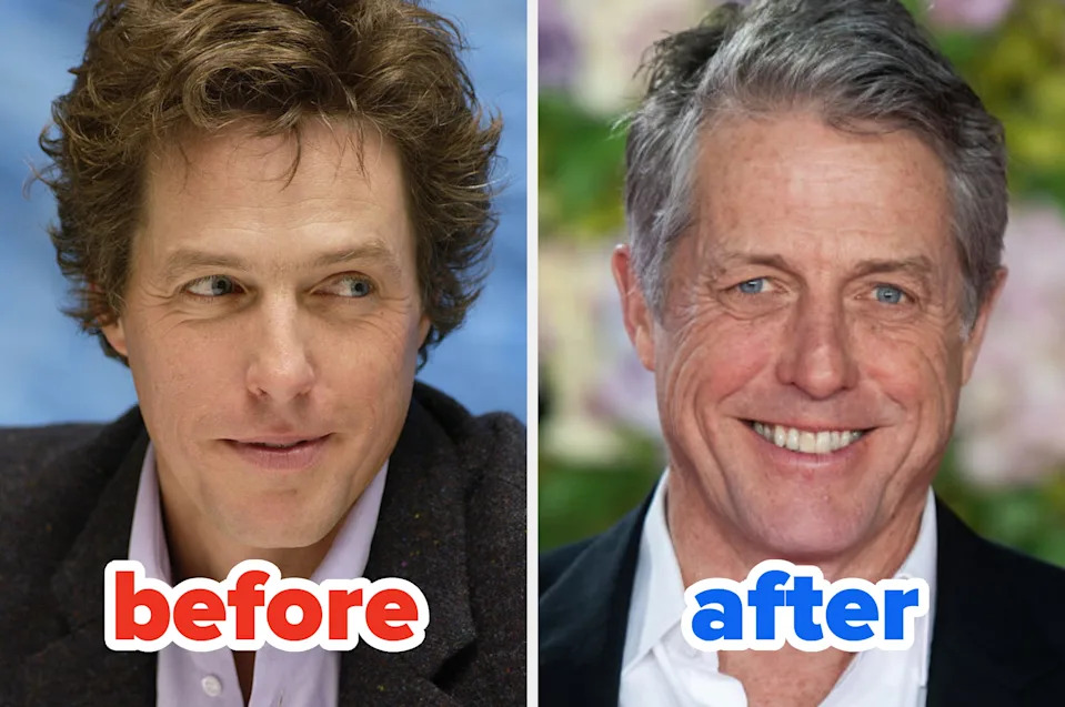 Side-by-side images show a man before and after; the "before" image has a serious expression, while the "after" image shows him smiling