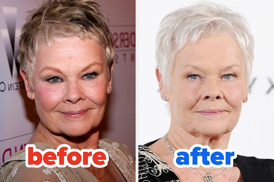 Two side-by-side images of a person, labeled "before" and "after," showing subtle changes in expression and lighting