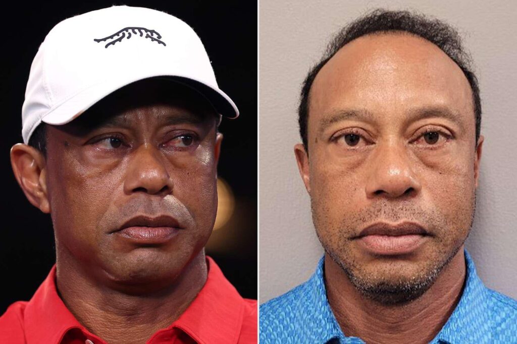 Tiger Woods Had Two Opioid Pills in His Pocket and 'Bloodshot and Glassy Eyes' When He Crashed