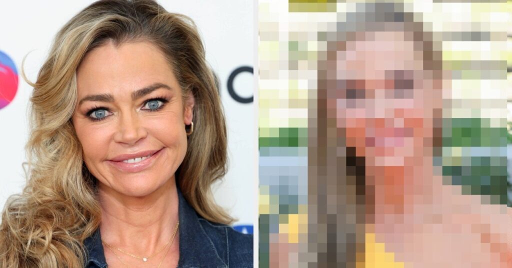 Denise Richard Posts Facelift Results Denise Richard Posts Facelift Results