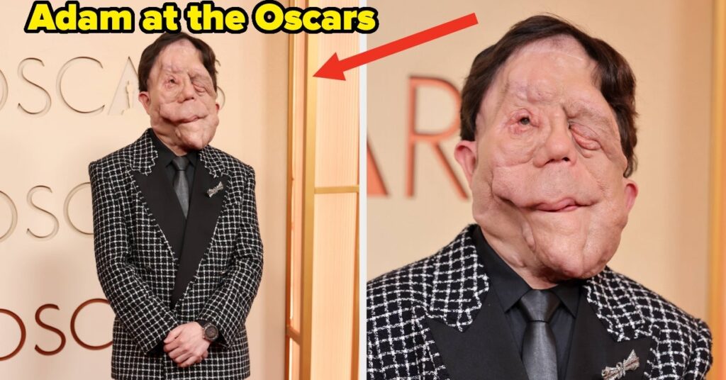 After A Comedian Made Fun Of His Appearance At The Oscars, Adam Pearson Responded Perfectly – BuzzFeed After A Comedian Made Fun Of His Appearance At The Oscars, Adam Pearson Responded Perfectly - BuzzFeed