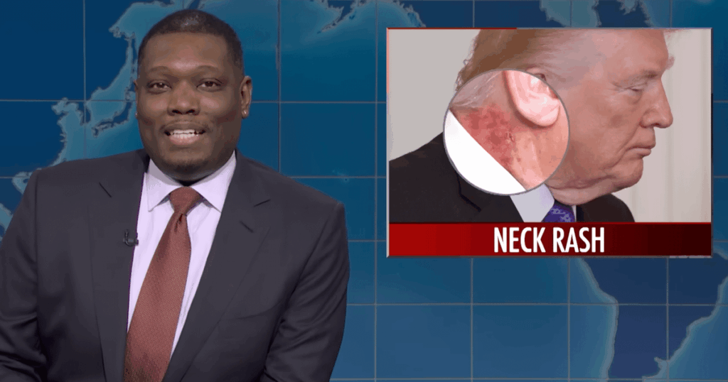 'Weekend Update' Names The Reason For Trump's Neck Rash... And Holy Moly