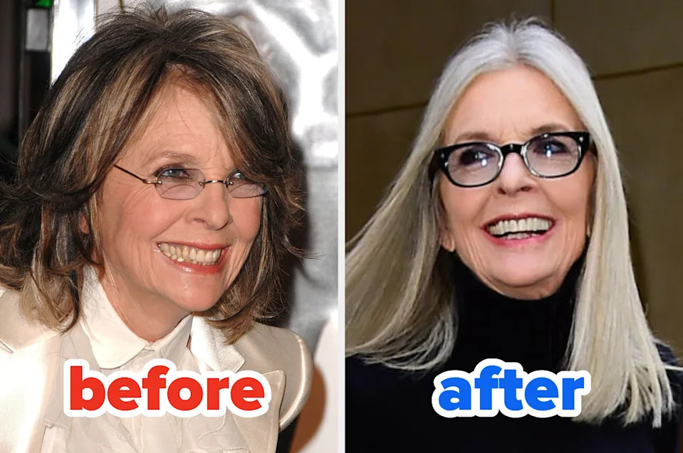 A person smiling in two images, labeled "before" and "after," wearing glasses and varying hairstyles