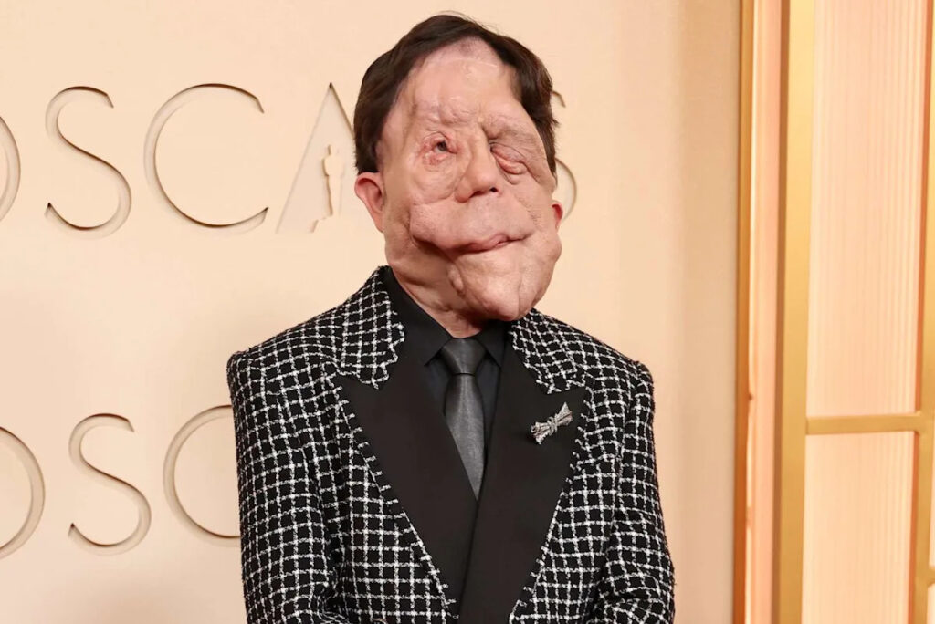 Adam Pearson Claps Back at Comedian Who Made Fun of His Appearance: ‘I’d Like to Not Have My Disability Mocked’ Adam Pearson Claps Back at Comedian Who Made Fun of His Appearance: ‘I’d Like to Not Have My Disability Mocked'