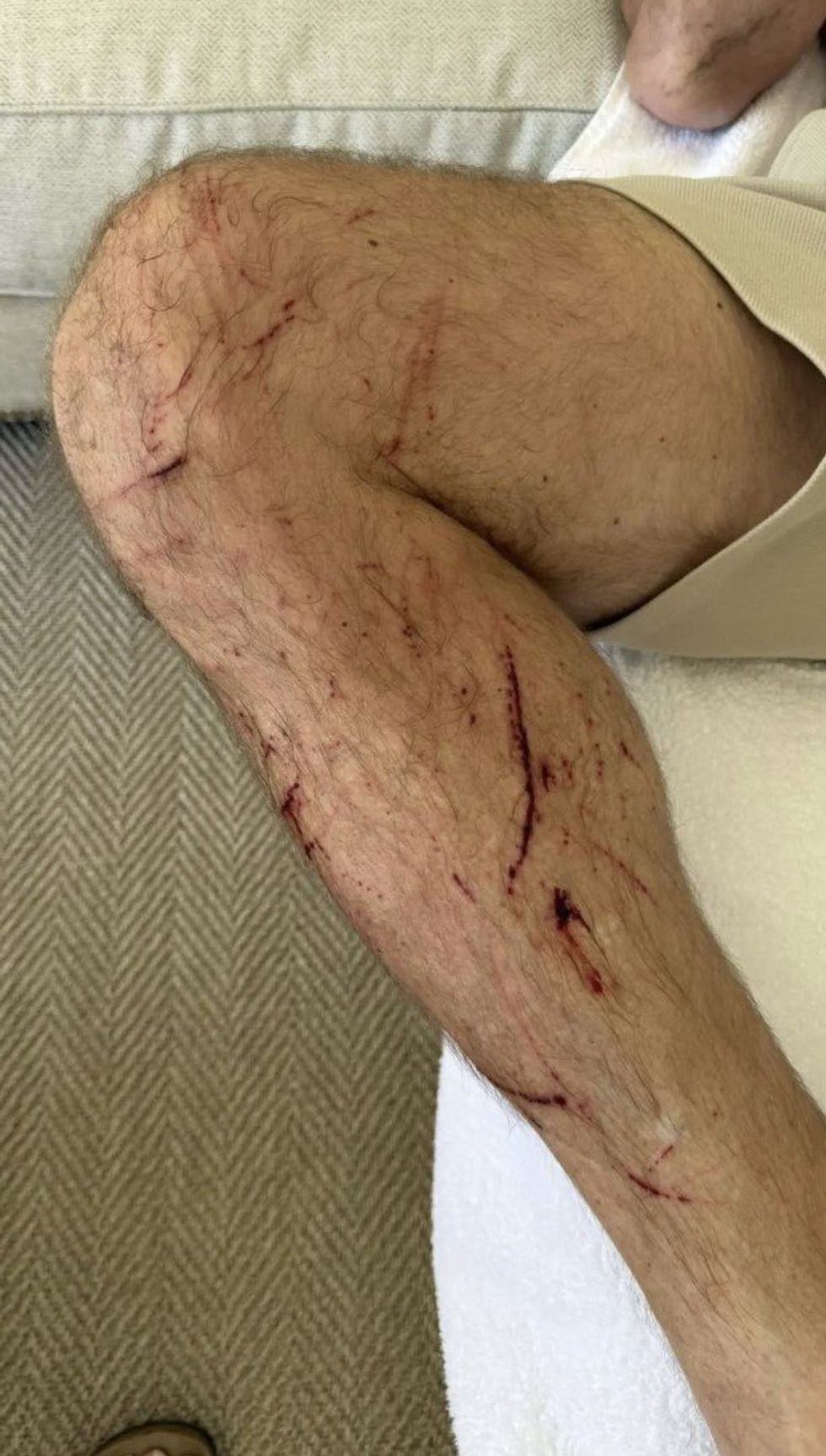 Alan Shearer blamed potholes for his bike crash