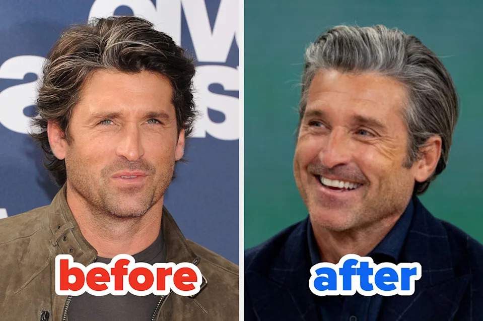 Two images side-by-side show a man with thick hair labeled "before" and him with grayer, shorter hair labeled "after," both smiling