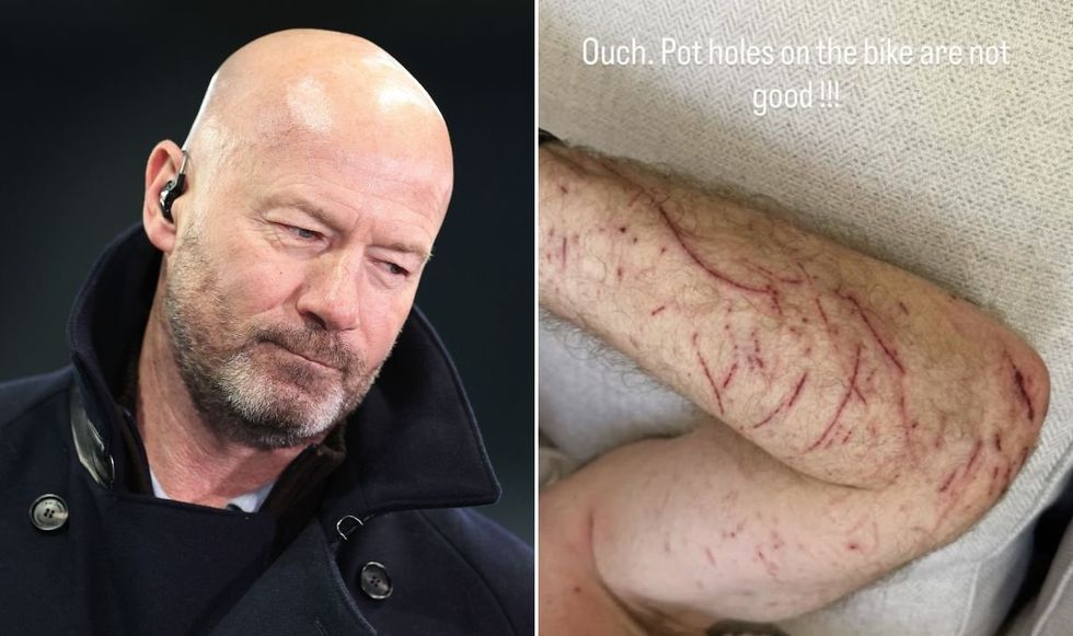 BBC pundit Alan Shearer has suffered gruesome injuries after his bike hit a pothole in major crash