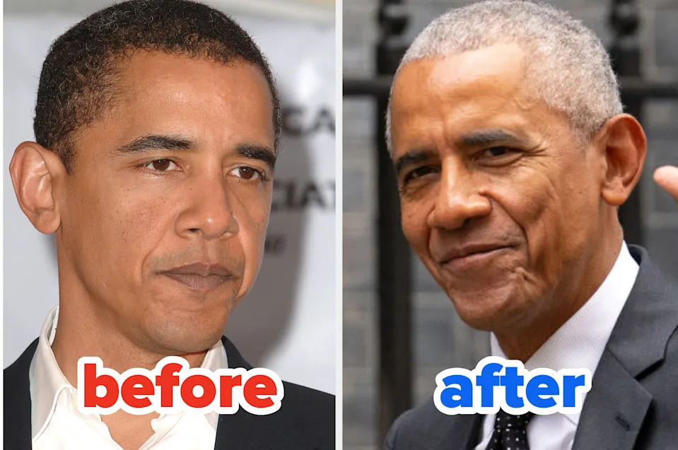 A person in formal attire is shown in two images side by side labeled "before" and "after," highlighting changes over time