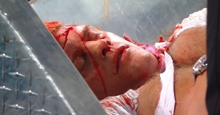 Orton turns heel and spills Cody Rhodes’ blood during WrestleMania contract signing Orton turns heel and spills Cody Rhodes’ blood during WrestleMania contract signing