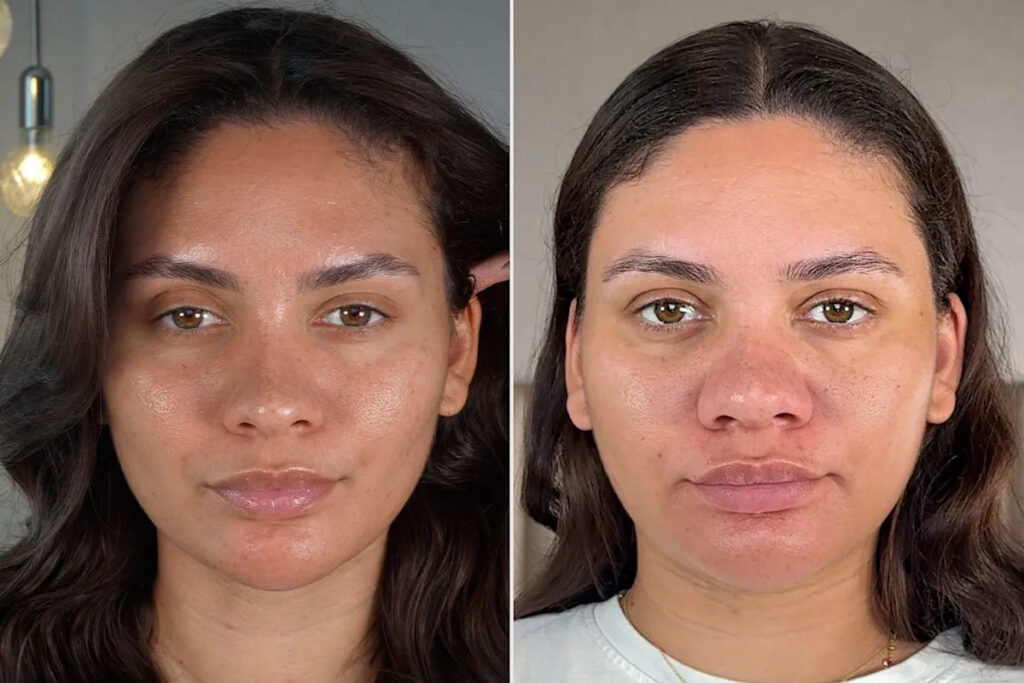 Beauty Influencer 'Unable to Recognize' Herself After Developing Unexpected Pregnancy Symptom at 4 Months (Exclusive)