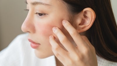 Whether you're inspired by K-beauty or Bollywood, dermatologists says these treatments are now a mainstream standard for healthy, well-maintained skin across all ages and ethnicities. (Shutterstock)