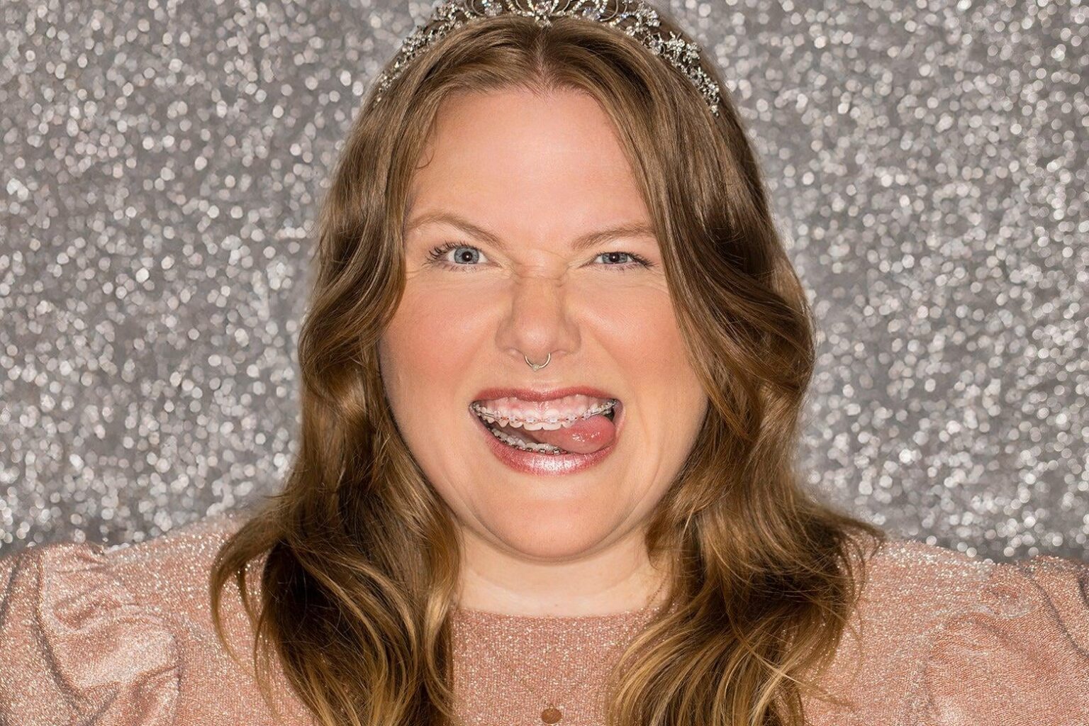 The Lindy West "Adult Braces" saga continues with an unhinged email from her husband