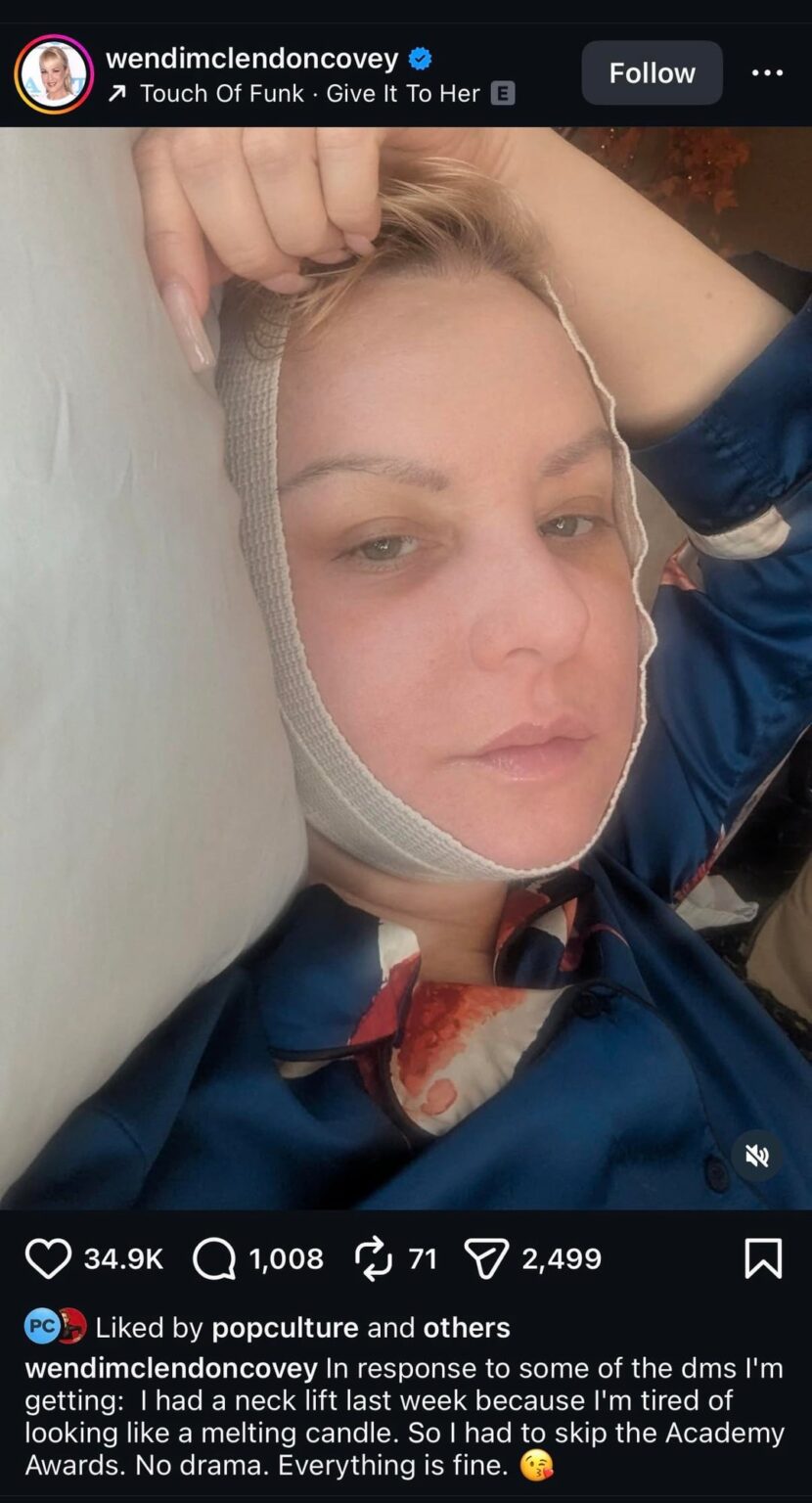 Wendi McLendon-Covey responds to questions about her missing the Bridesmaids reunion at the Oscars: "I had a neck lift last week because I'm tired of looking like a melting candle."