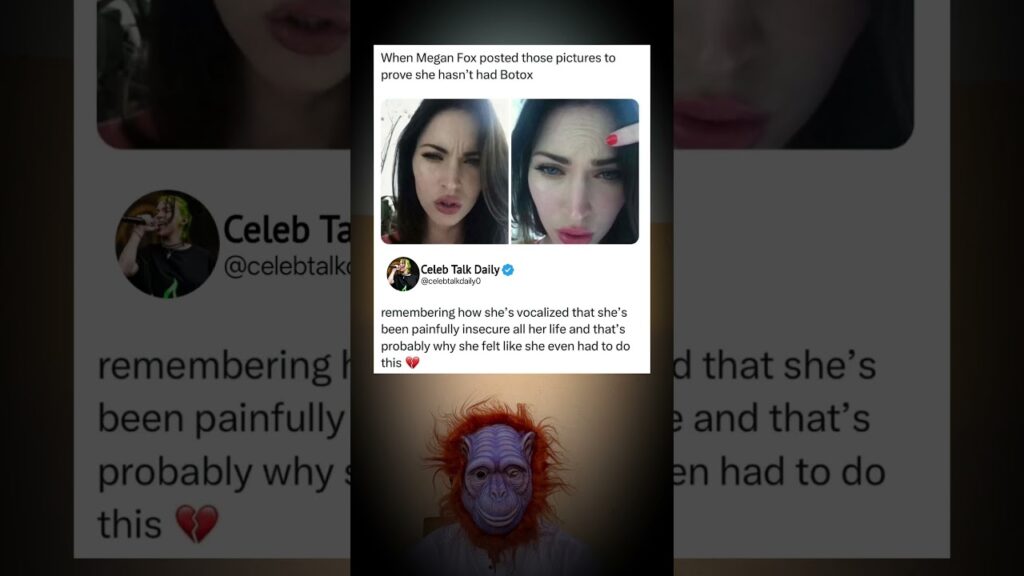 Megan Fox Shuts Down Botox Rumors… But Fans Feel Heartbroken 💔 Megan Fox Shuts Down Botox Rumors… But Fans Feel Heartbroken 💔