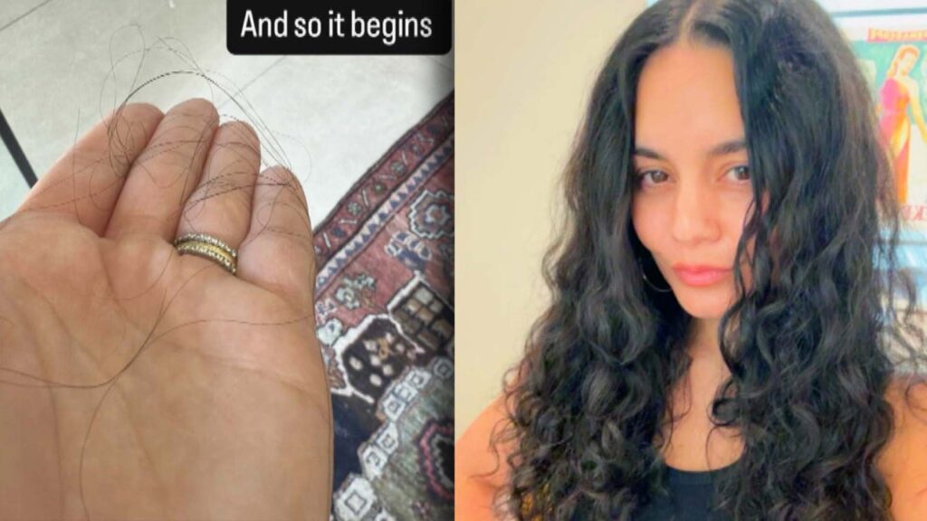 Vanessa Hudgens Shares Her Postpartum Side Effect On Social Media