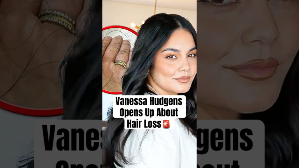 Vanessa Hudgens Opens Up About Hair Loss #shorts #vanessahudgens #postpartum