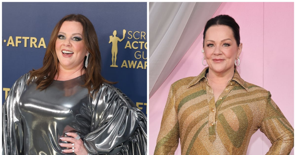 Emmy-Winning Comedian Shows Off Jaw-Dropping Weight Loss