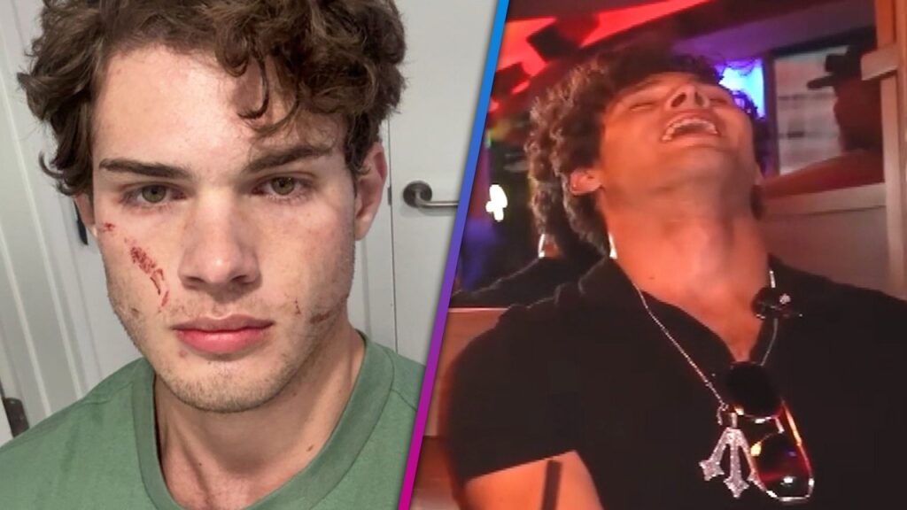 Clavicular Speaks Out After 'Brutal' Overdose on Livestream