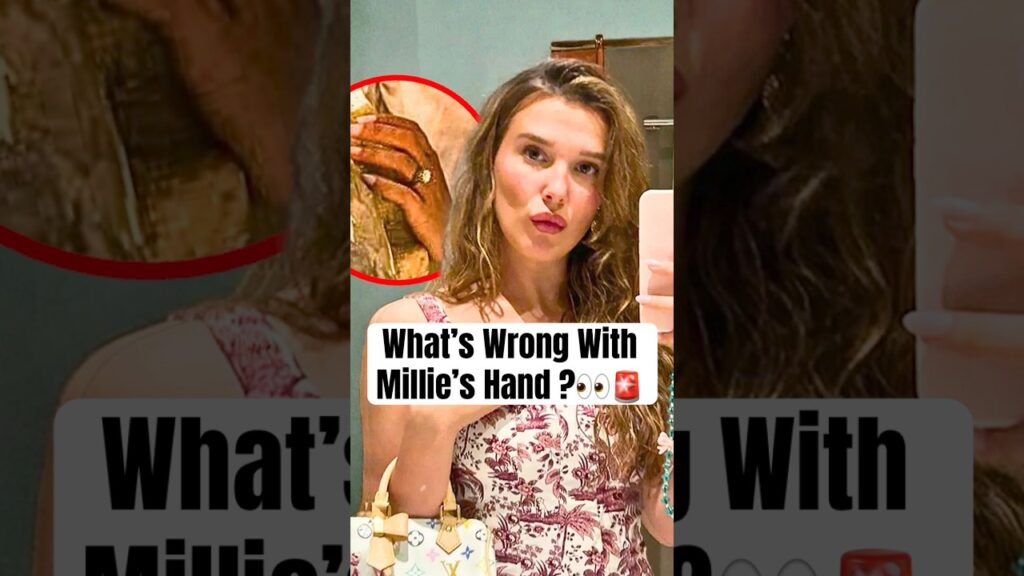 What’s Wrong With Millie’s Hand? #shorts #milliebobbybrown #enolaholmes3