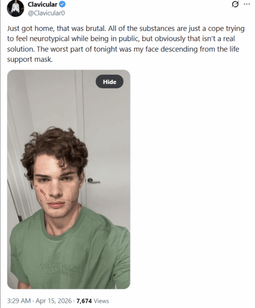 Clavicular posts statement after coming home from hospital following suspected overdose