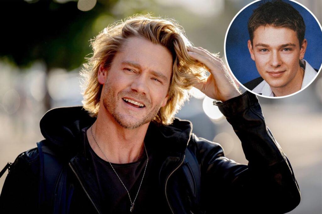 Chad Michael Murray fans stunned by 'unrecognizable' photo of actor before nose injury transformed his face