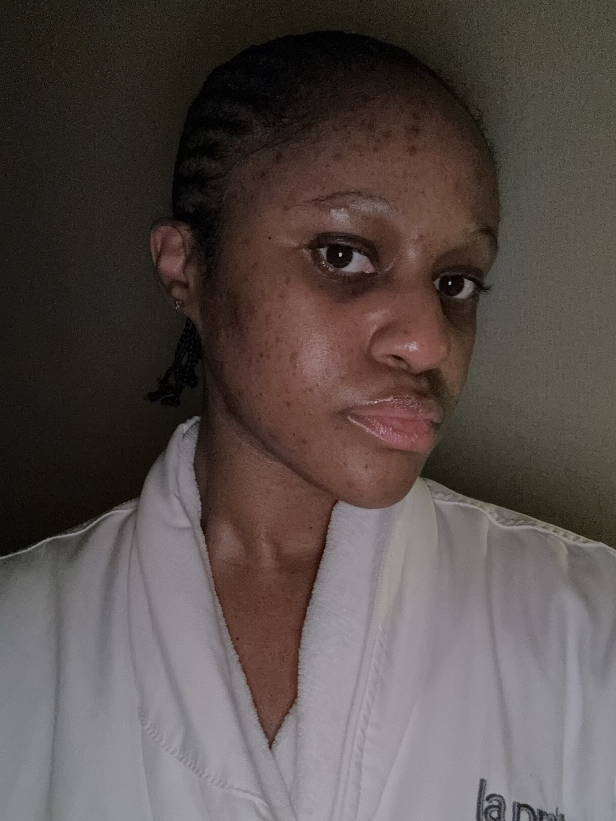 I Tried This Celebrity-Favorite Facial Ahead Of The Met Gala