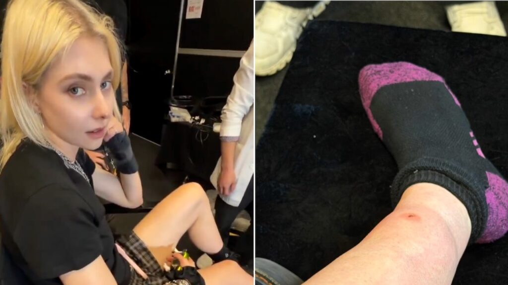 Taylor Momsen Bit By Venomous Spider on AC/DC Tour After Previously Being Bit by Bat