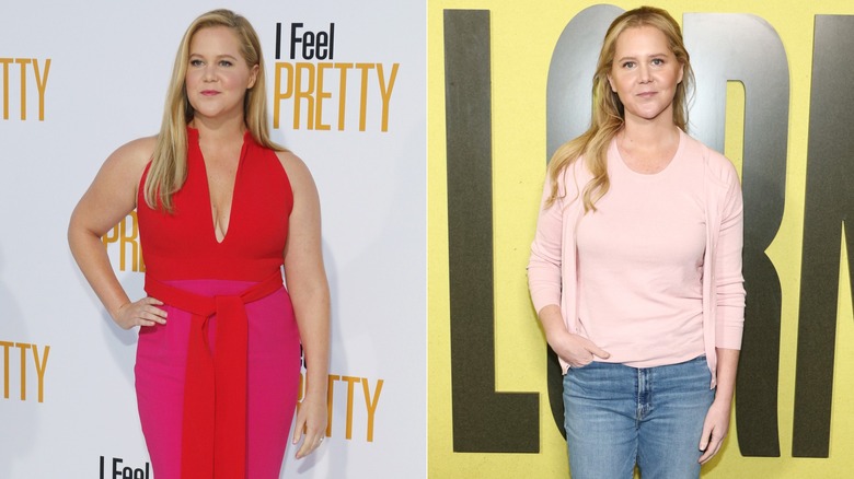 Amy Schumer before and after a weight loss transformation assisted by GLP-1 mediction