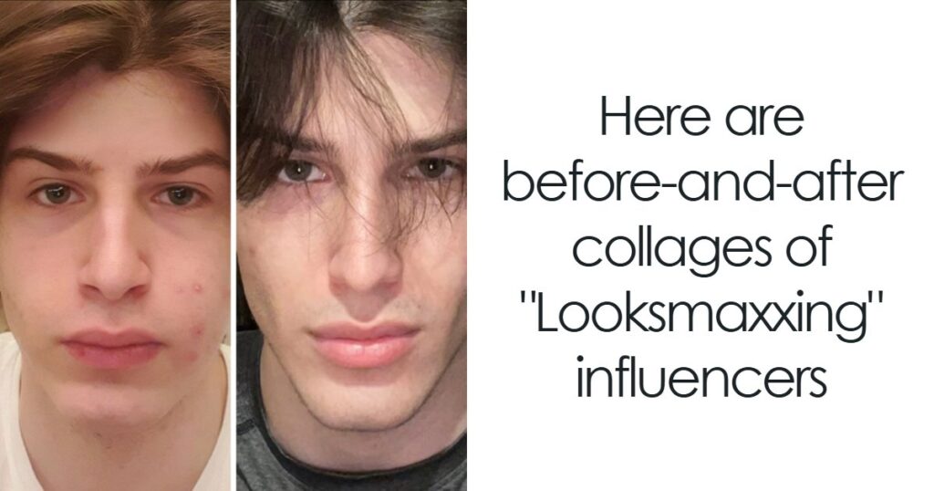 From Bone Smashing To Chin Extensions, Here Are Before-And-After Collages Of "Looksmaxxing" Influencers