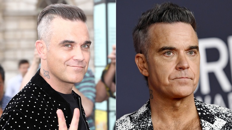 Robbie Williams before and after GLP-1 drugs