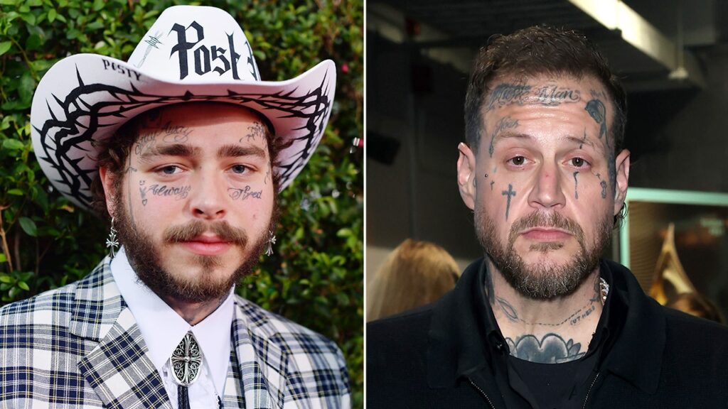 Post Malone postpones tour with Jelly Roll by weeks: ‘We ain’t ready