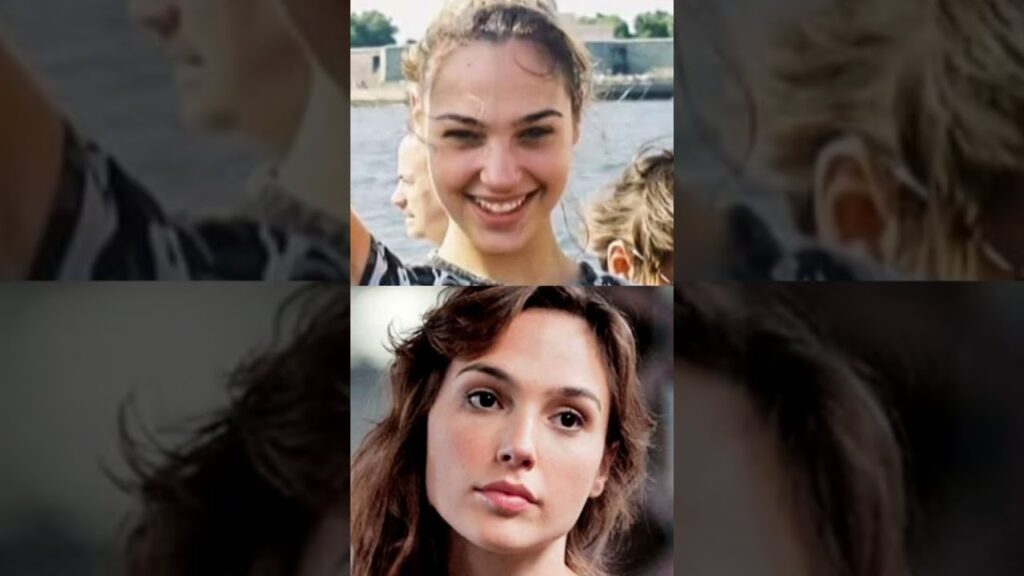 Gal Gadot plastic surgeries