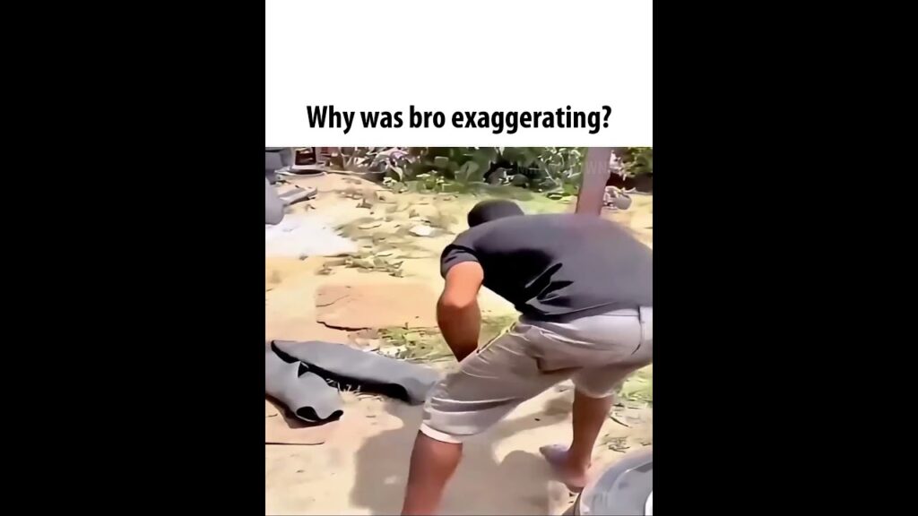 Bro's fingertips are gone 😭
