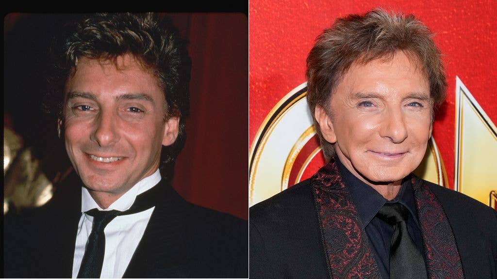 split photo of barry manilow before and after facelift