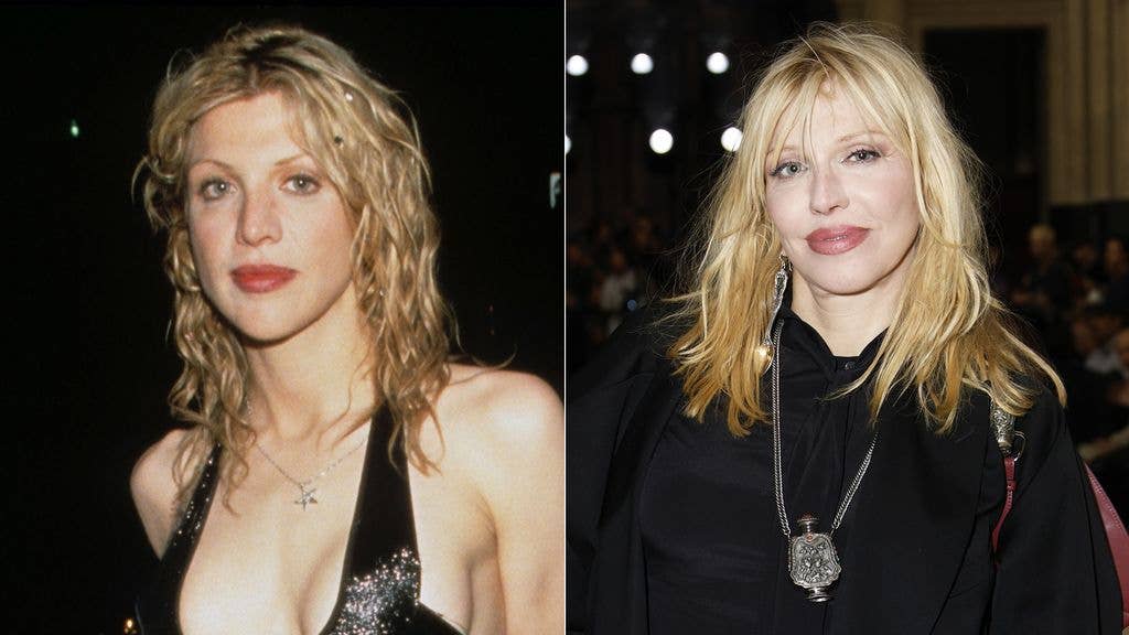 split photo of courtney love before and after facelift
