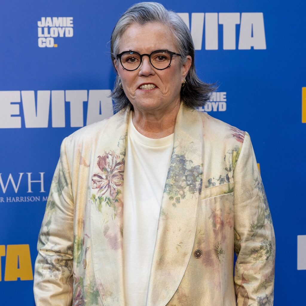 Rosie O’Donnell’s Facelift Cost More Money Than a Car