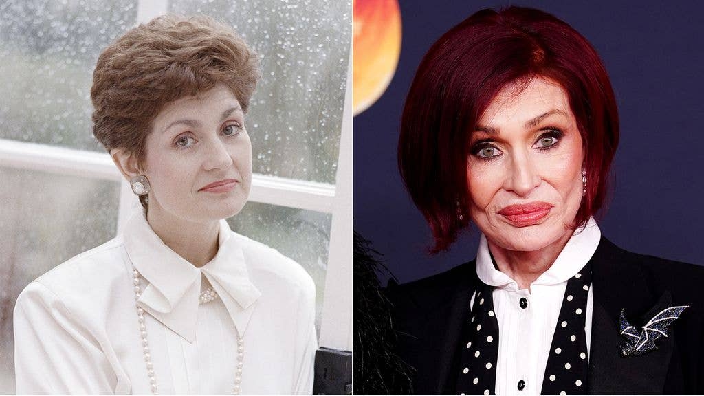 split photo of sharon osbourne before and after facelift
