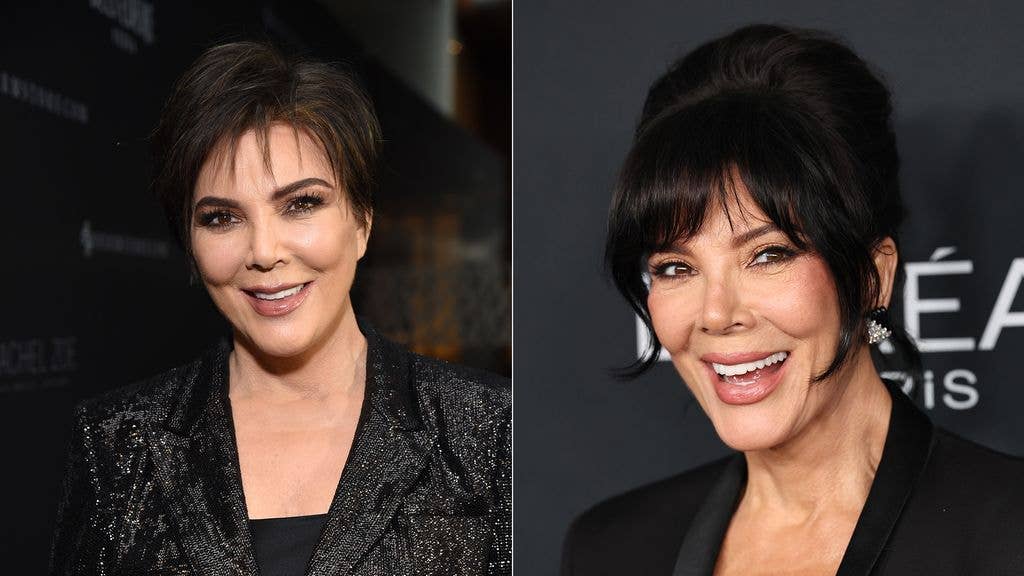 split photo of kris jenner before and after facelift