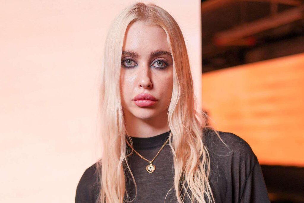 Euphoria's Chloe Cherry Says She's Had So Much Lip Filler That She No Longer Needs Numbing Cream