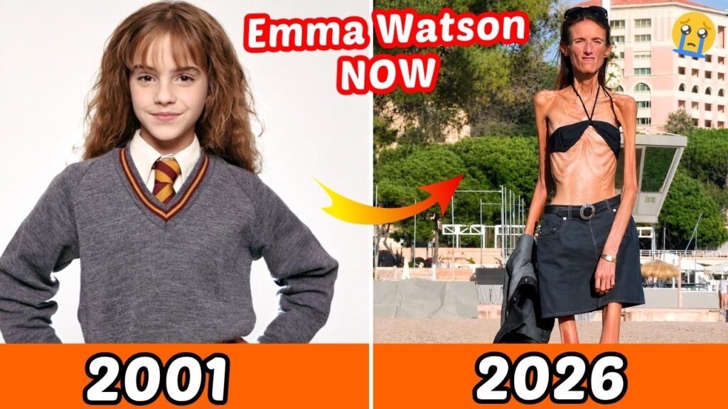 Harry Potter Cast Then vs Now 2026: Emma Watson’s Shocking Transformation Harry Potter Cast Then vs Now 2026: Emma Watson's Shocking Transformation