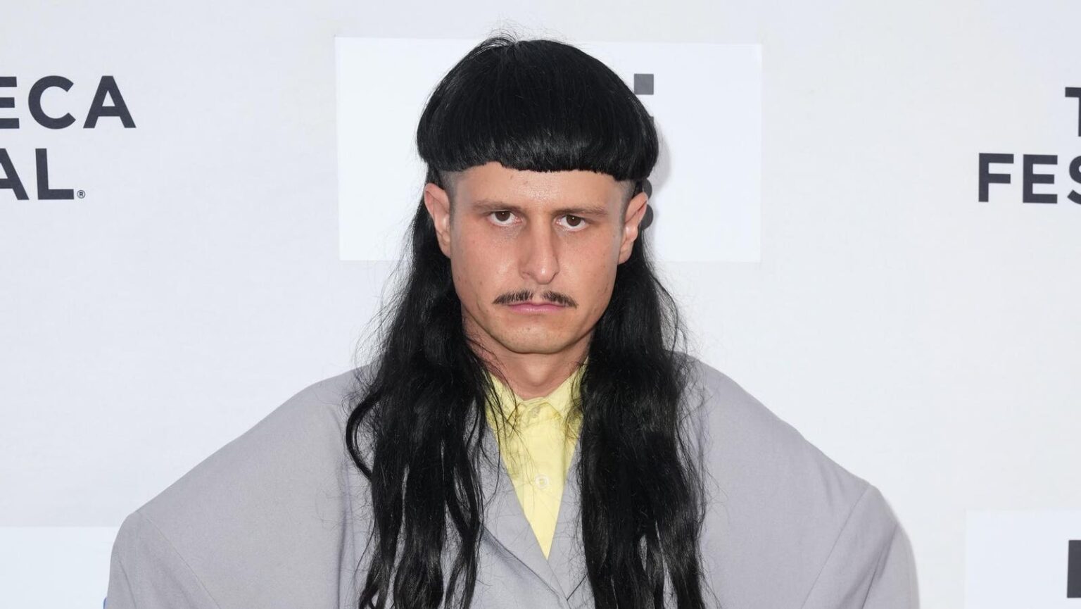 Oliver Tree, ‘Life Goes On’ And ‘Miss You’ Singer, Dies At 32 Oliver Tree, ‘Life Goes On’ And ‘Miss You’ Singer, Dies At 32