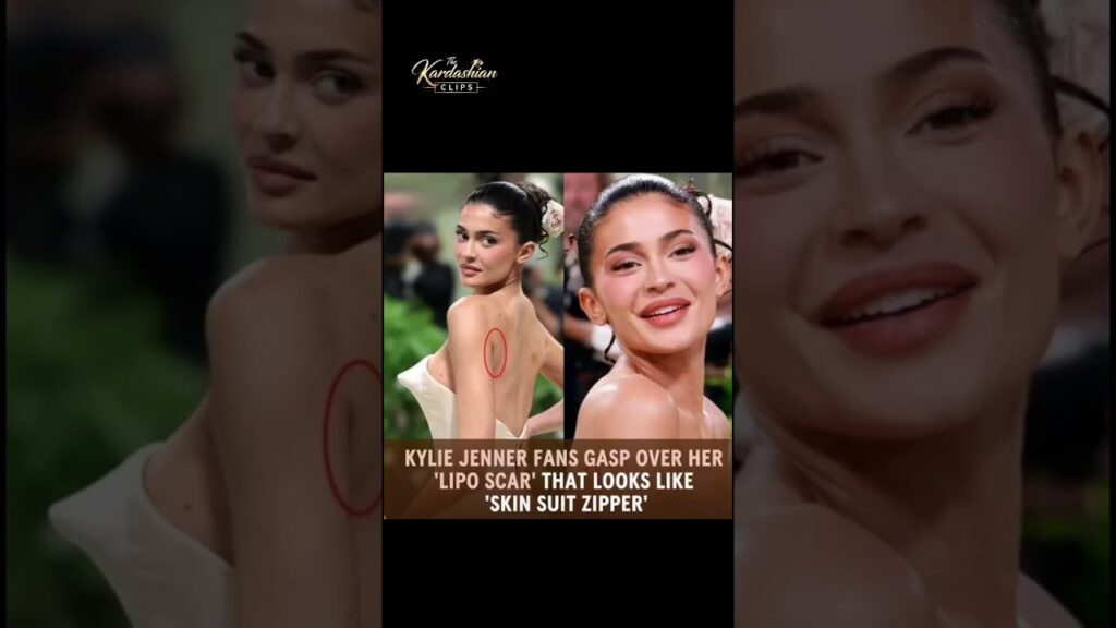 kylie's scar #viral #thekardashians #jenner #kimkardashian #funny #love #kendalljenner #kim #fashion