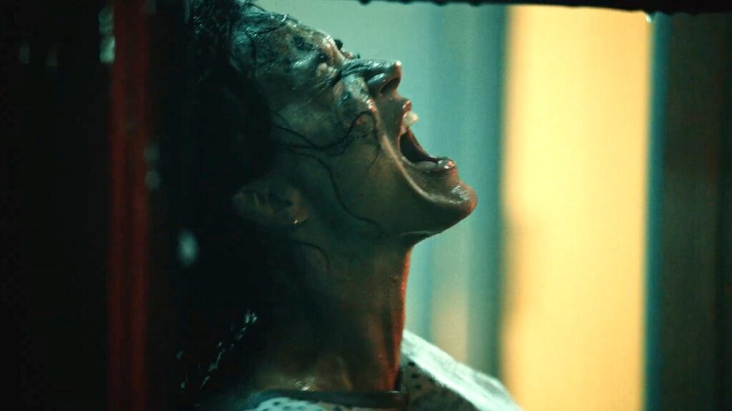 Katy Perry Escapes Hospital Covered in Scars in FIERY Watch It Burn Music Video