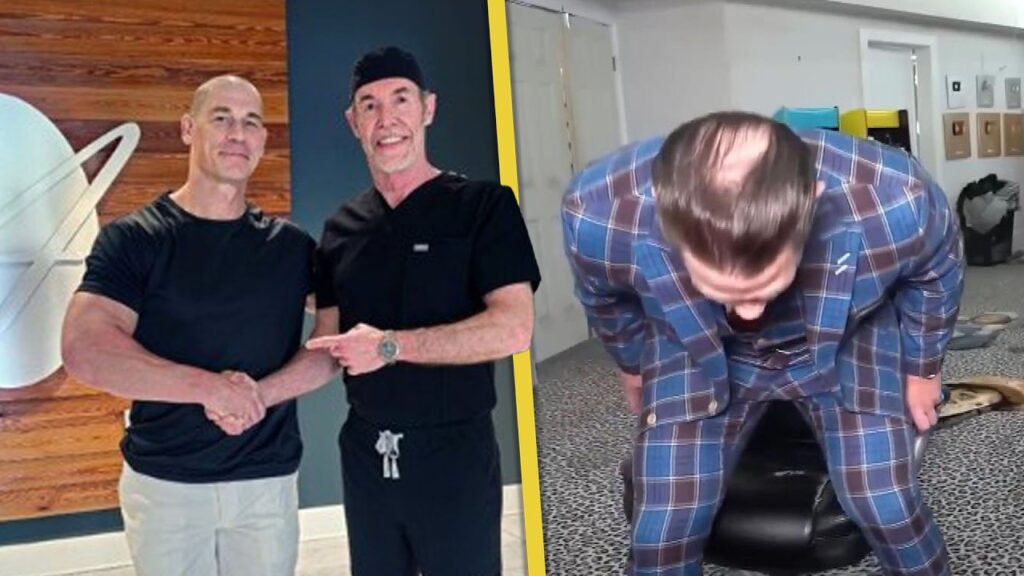 John Cena SHAVES HIS HEAD While Revealing 2nd Hair Transplant Procedure